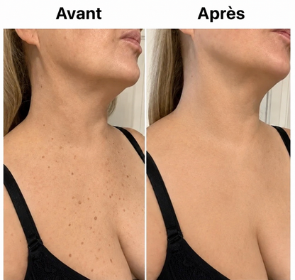 Espace Santé FR – Stick Corporel Glycolique Lissant