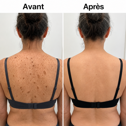 Espace Santé FR – Stick Corporel Glycolique Lissant
