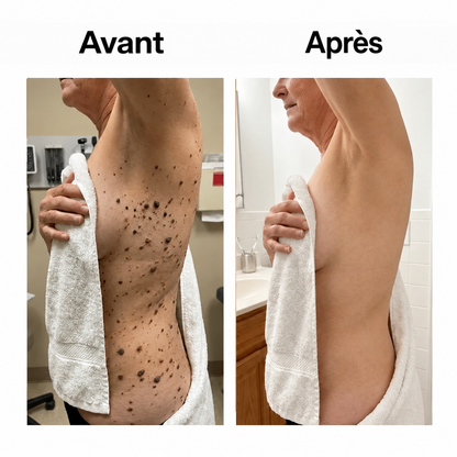 Espace Santé FR – Stick Corporel Glycolique Lissant
